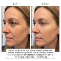 Before and after Day 1 to Day 60 – Caroline, 42, eye area wrinkles