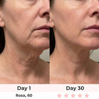 Before and after Day 1 to Day 30 – Rosa, 60, neck and jawline