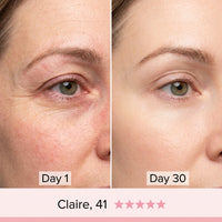 Before and after Day 1 to Day 30 – Claire, 41, eye area close-up