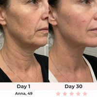 ELMIRA SKIN LED Facial Sculptor product image